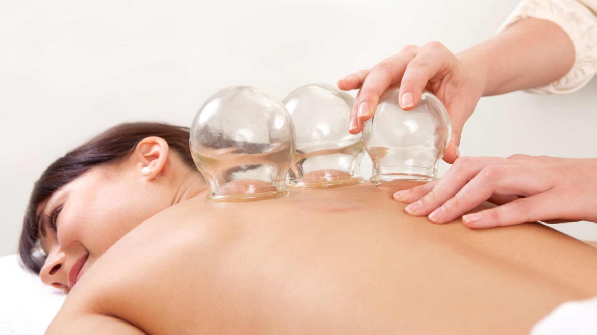 Cupping (incl 15 min. massage)